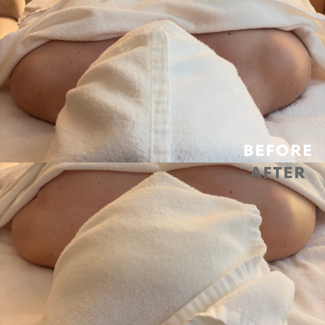 巻き肩リンパマッサージモニター⑥様