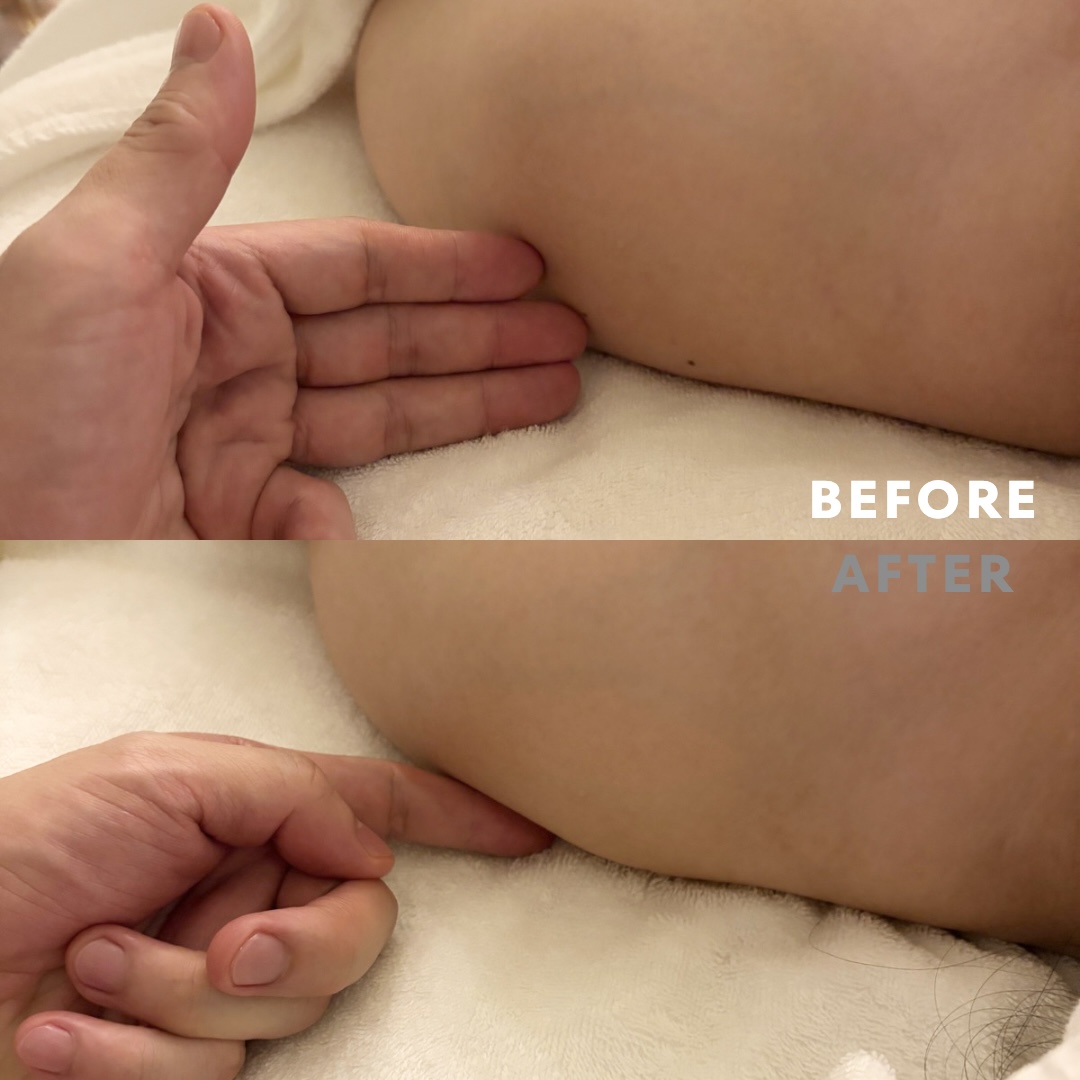 巻き肩リンパマッサージモニター④様