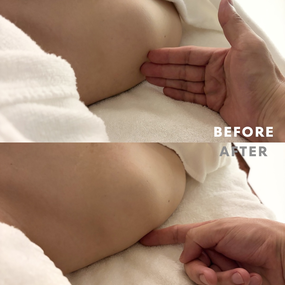 巻き肩リンパマッサージモニター④様