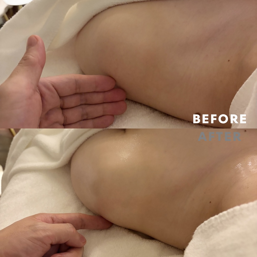 巻き肩リンパマッサージモニター⑨様