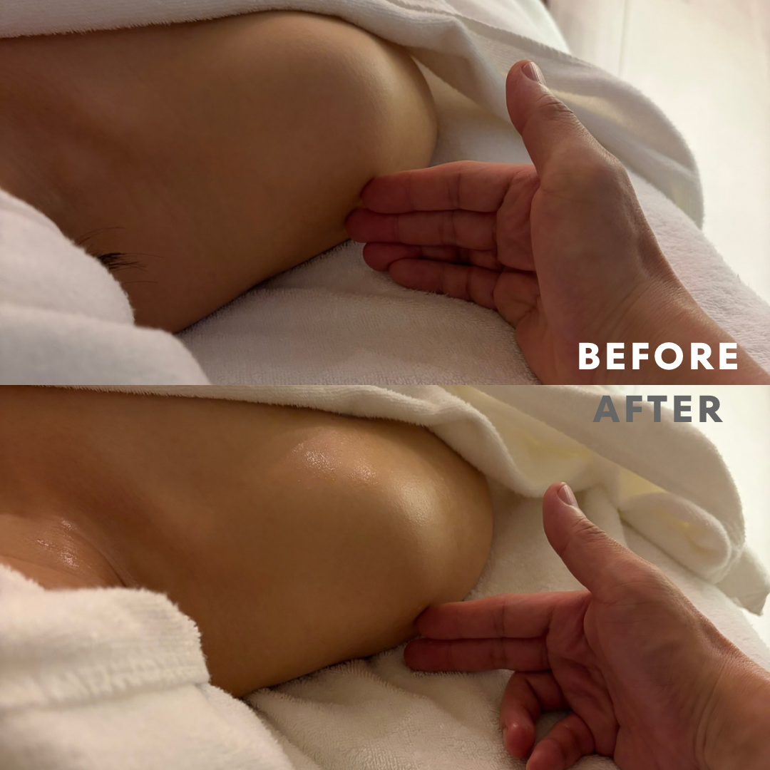 巻き肩リンパマッサージ巻き肩モニター①様