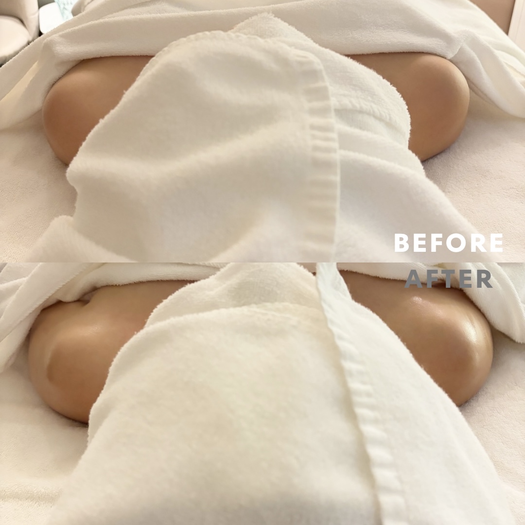 巻き肩リンパマッサージモニター⑦様