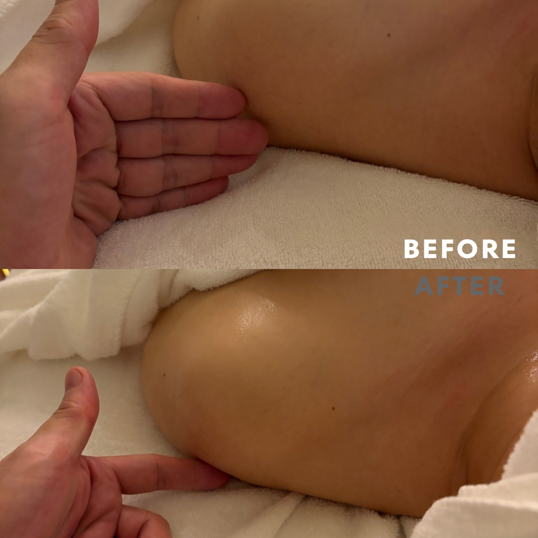 巻き肩リンパマッサージモニター①様