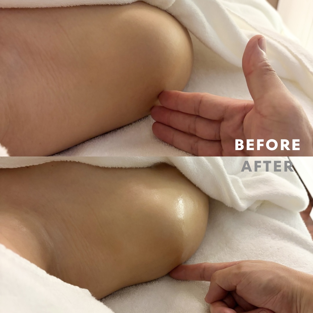 巻き肩リンパマッサージモニター⑧様