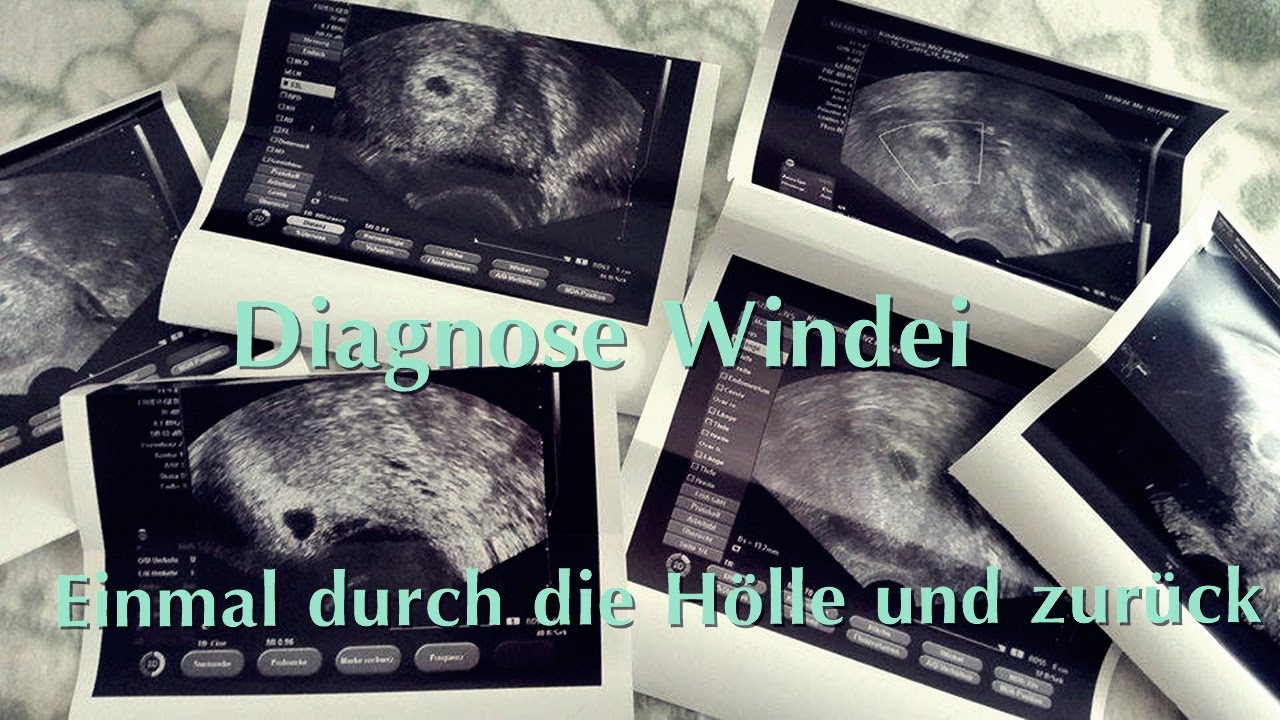 Windei Sternenkind Info Berichtet U A Ueber Waehrend Der Schwangerschaft Geburt Oder Kurz Danach Verstorbene Kinder