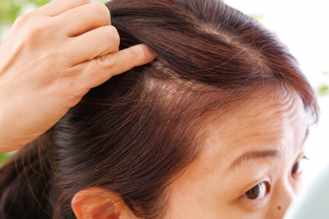 女性の薄毛に悩む方へ｜原因と対処、医療相談という選択肢
