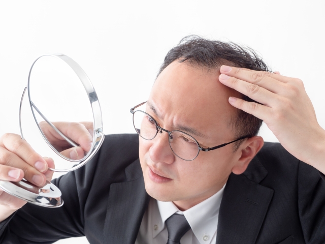 抜け毛が増えてきた男性へ｜原因と対策、医療相談という選択肢