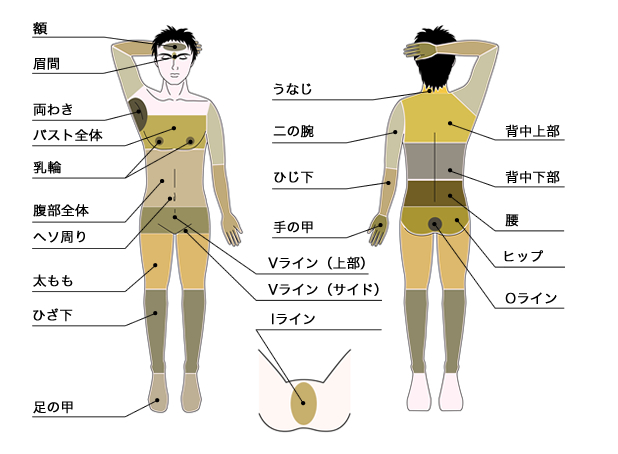メンズ脱毛　メンズディオーネ大阪梅田店脱毛部位一覧