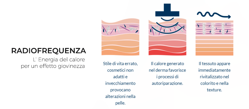 RADIOFREQUENZA VISO