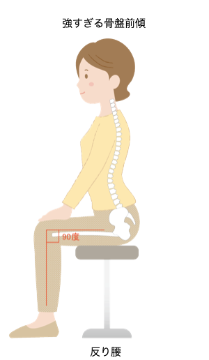 座っているときの強すぎる骨盤前傾のイメージ　姿勢改善・歩き方改善ラボ【㈱n-position】骨盤コントロール補助器「ニュートラル」開発会社