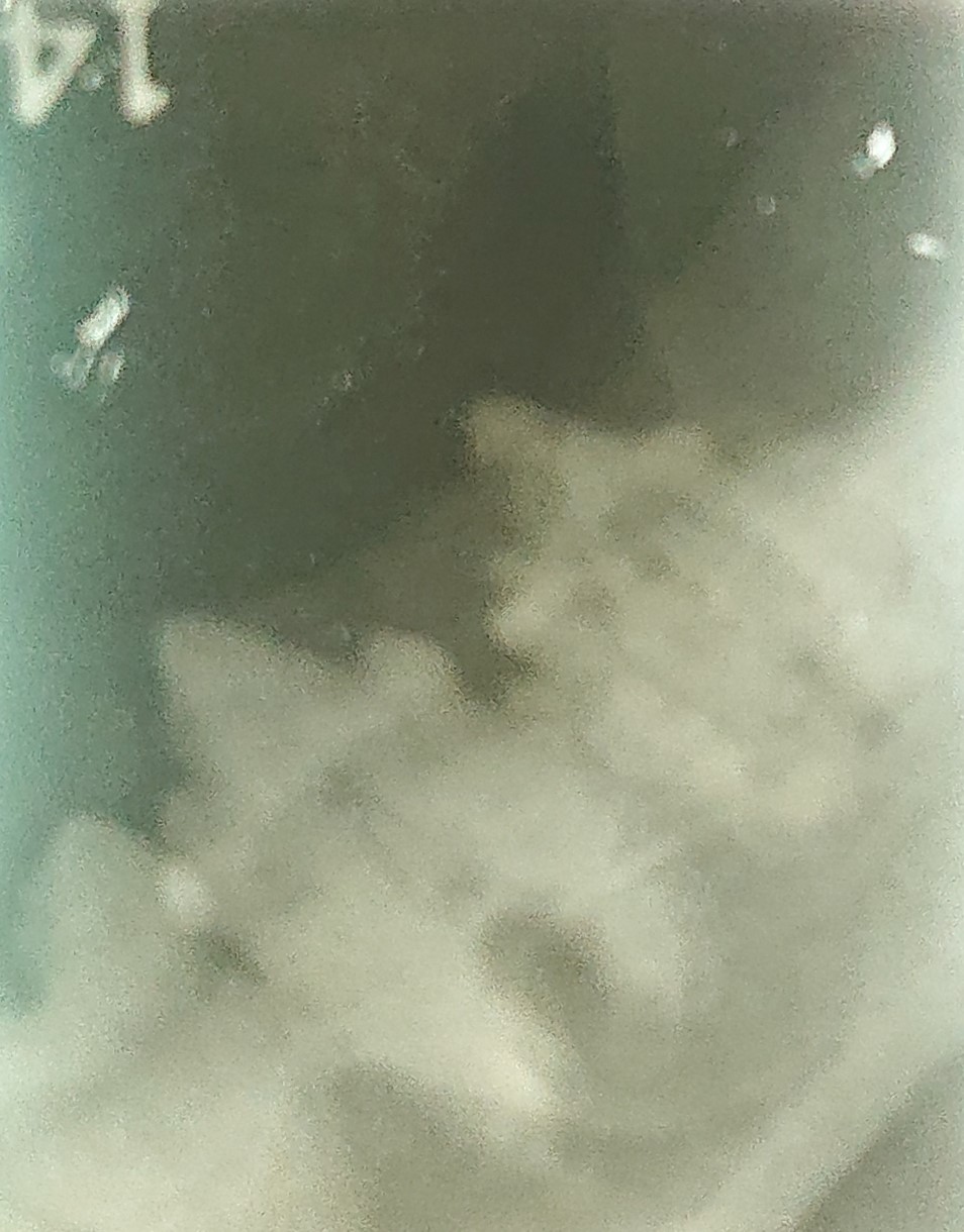 レントゲン検査で一部歯冠欠損像