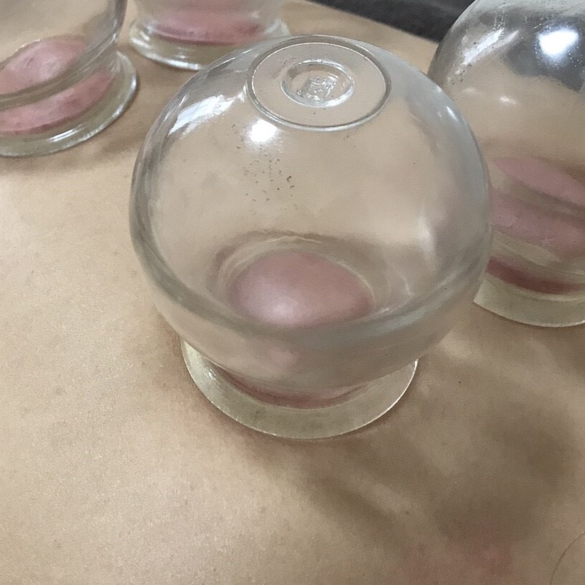 吸玉治療