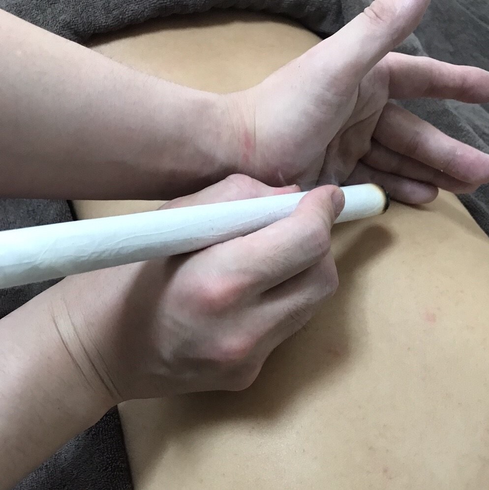 棒灸治療