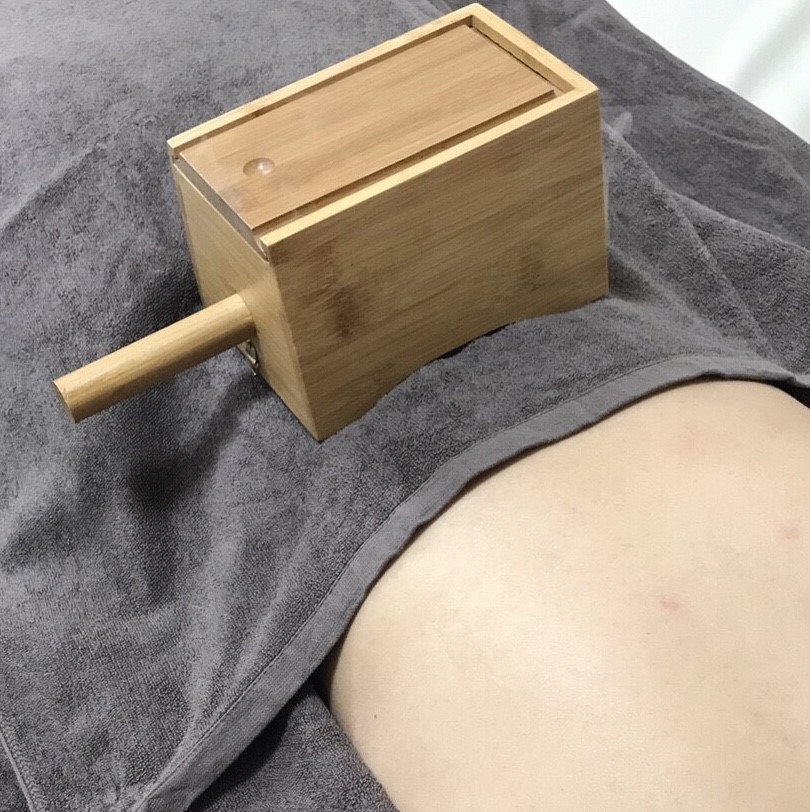 温灸（箱灸）治療