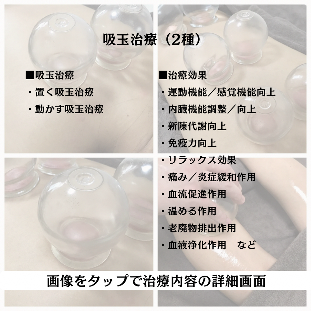 吸玉治療の内容