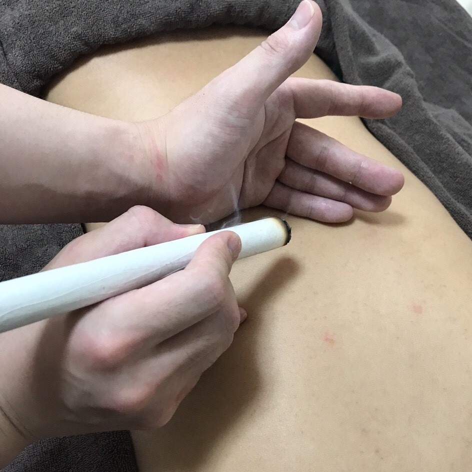 棒灸治療