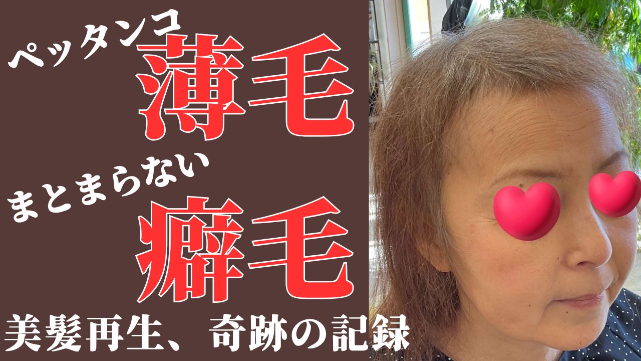 女性の薄毛問題は深刻・・・