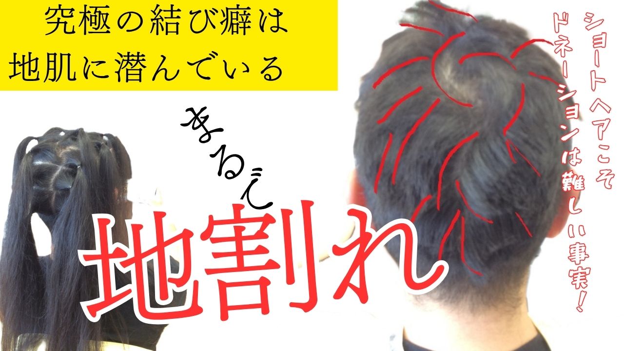 ヘアドネーションの「悪魔」は地肌に潜んでいる