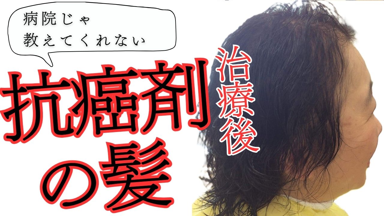 病院じゃ教えてくれない抗がん剤治療後の髪の事