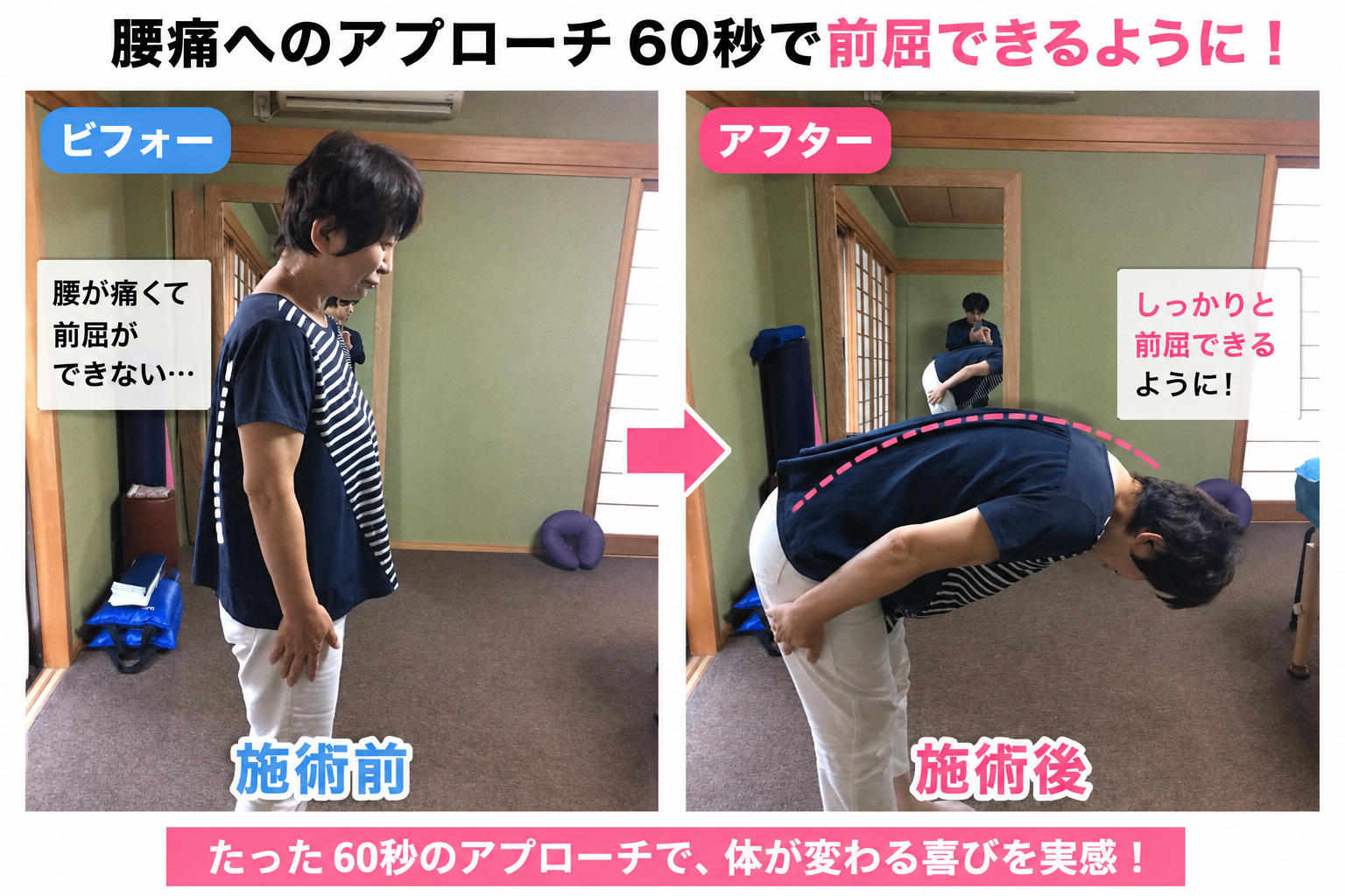 腰痛ビフォーアフター