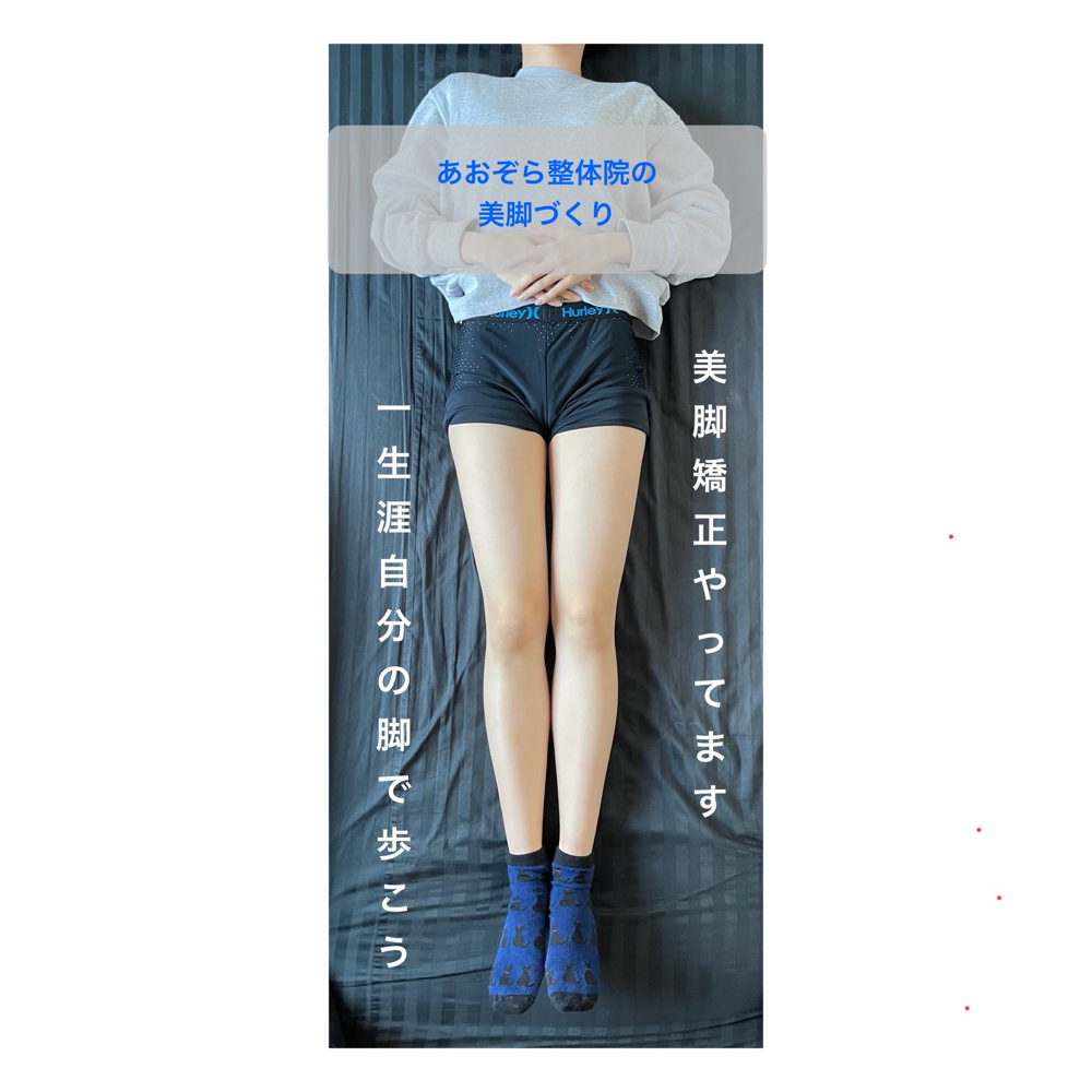 徳島のあおぞら整体院のO脚矯正(美脚矯正)を受け、脚のラインが整い、まっすぐで美しい脚になった女性の脚の写真