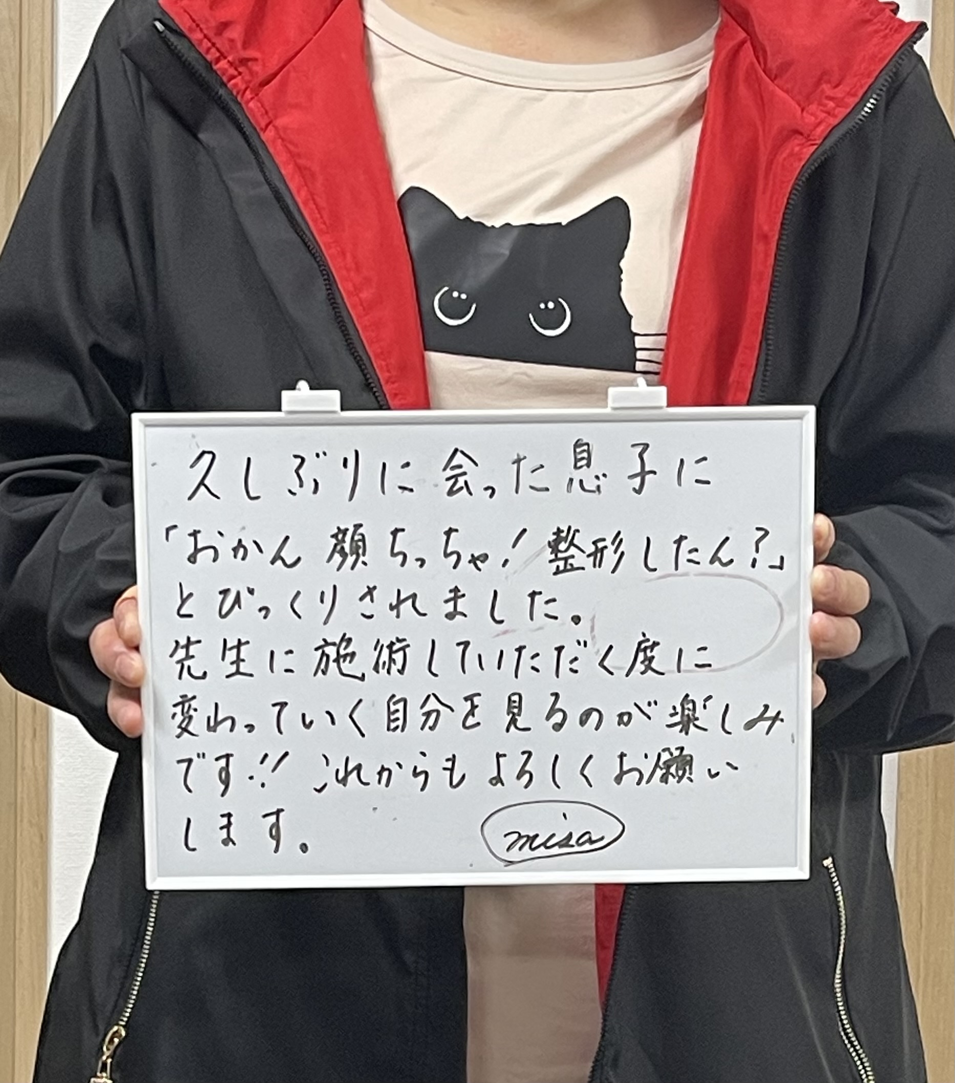 50代女性・徳島市・顔に触る小顔矯正の体験談