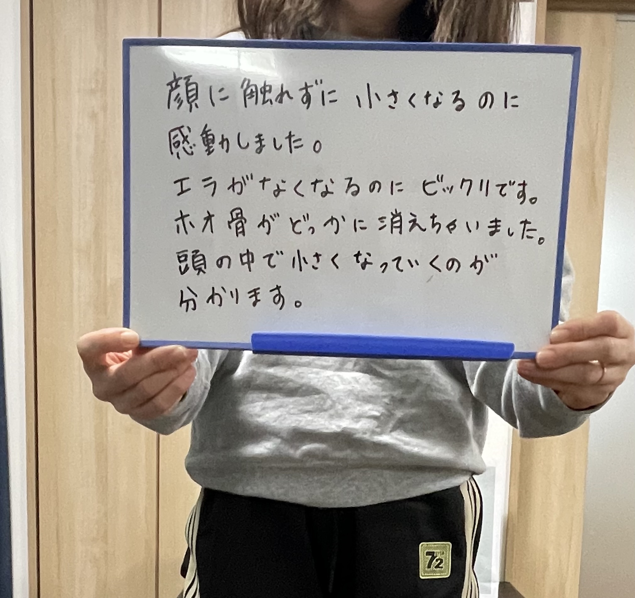 20代女性・徳島市・ハイエンド小顔矯正の体験談