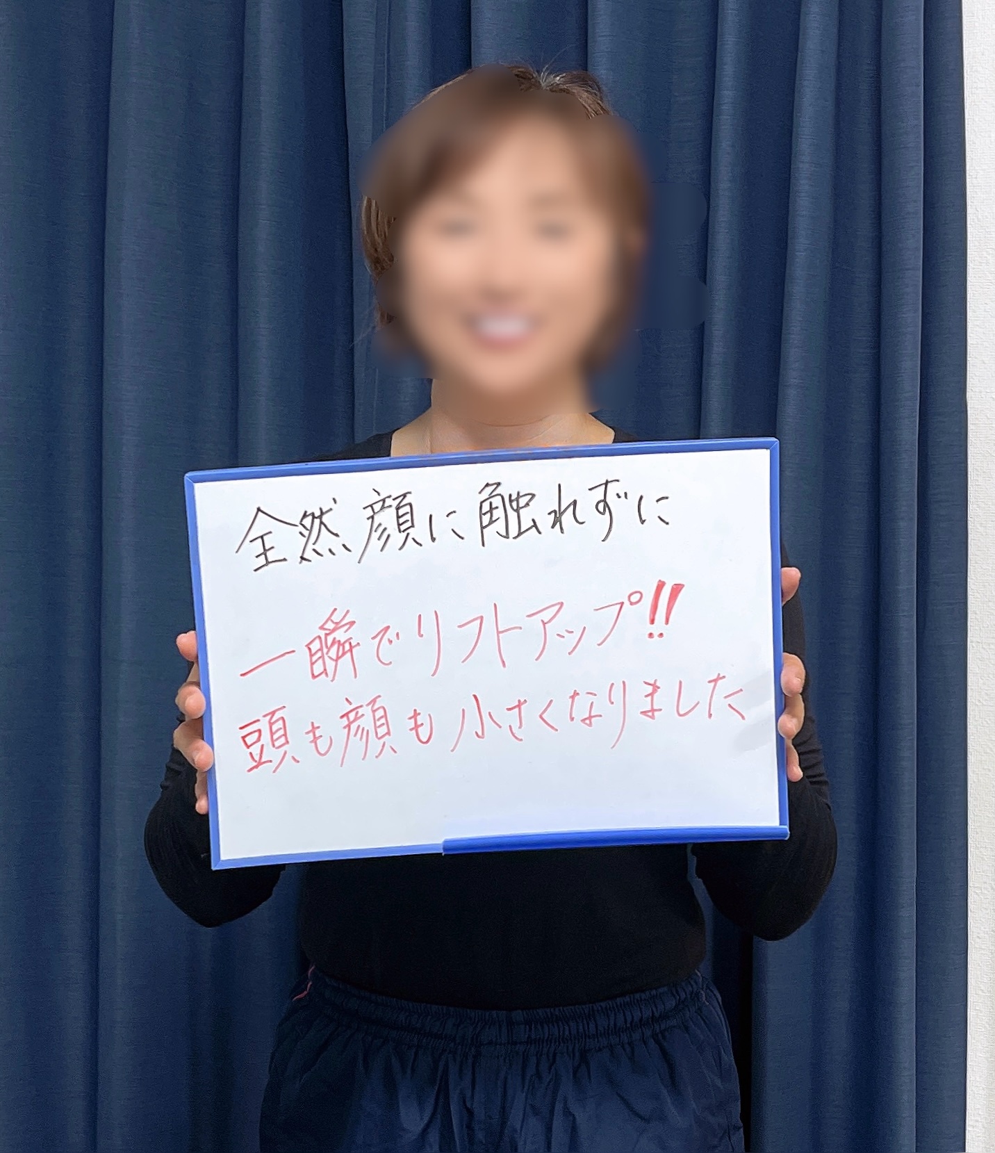 50代女性・神戸市・ハイエンド小顔矯正の体験談
