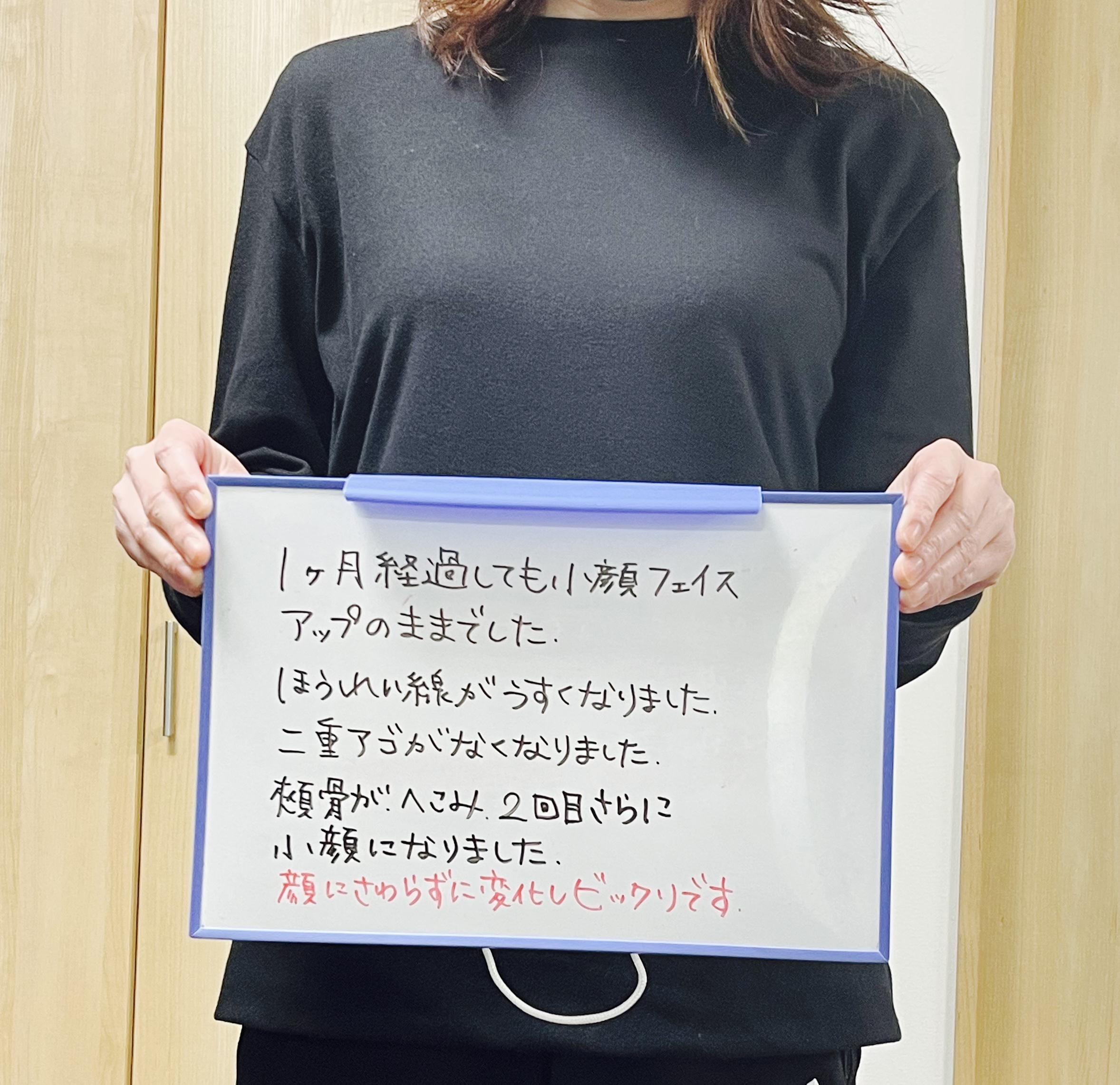40代女性・鳴門市・ハイエンド小顔矯正の体験談