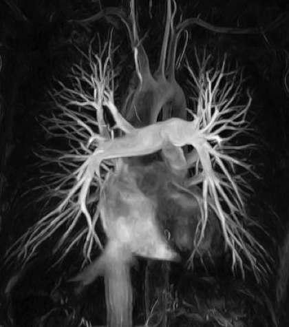 Resonancia Magnética