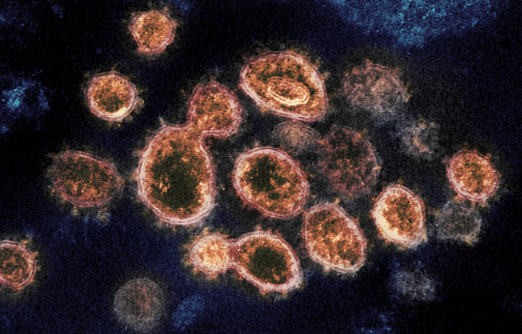 11 Strategies To Treat Coronavirus You Should Know