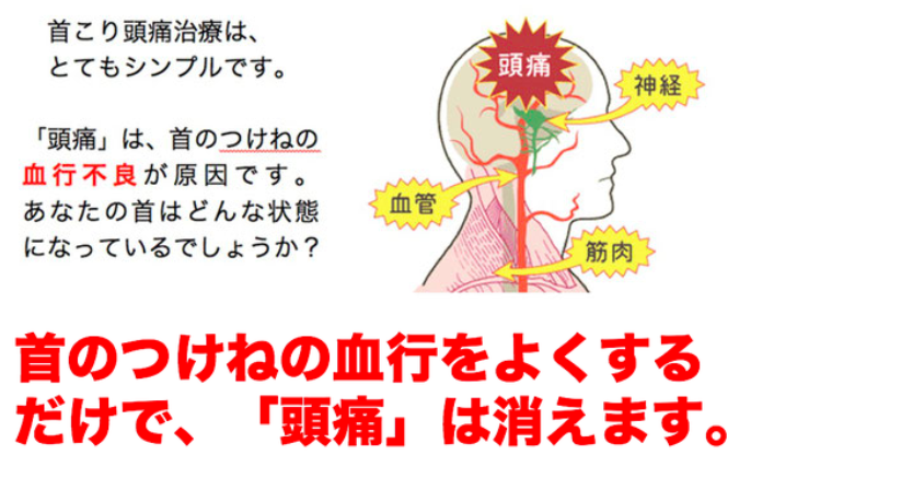 首こり頭痛はとてもシンプルです。「頭痛」は、首のつけねの血行不良が原因です。あなたの首はどんな状態になっているでしょうか？首のつけねの血行をよくするだけで頭痛、偏頭痛は消えます。