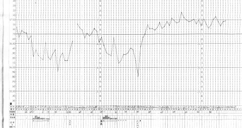 漢方を飲み始めて約５カ月、ついに子供を授かる事ができた女性３５歳（高プロラクチン血症・子宮筋腫）の基礎体温表（by新潟市の子宝・不妊・妊活漢方薬専門店「西山薬局」）