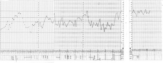 ５年間の無月経・無排卵を乗り越えタイミング法で妊娠された女性２８歳の基礎体温表（by新潟市の子宝・不妊・妊活漢方薬専門店「西山薬局」）