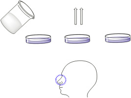 Graphic which shows producing steps and nasal application of naphazoline
