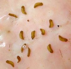 Auf dem Foto kann man mal versuchen, Blutegel und Embryo zu unterscheiden. Was ist abgebildet? (Ich habe es nicht eindeutig sagen können.)