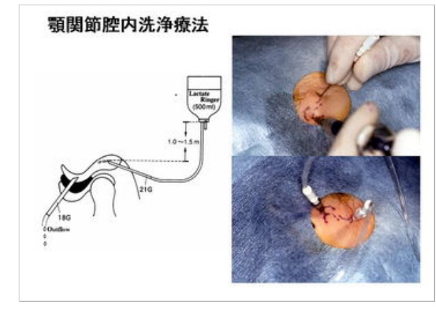 治療 痛 法 関節 症 額
