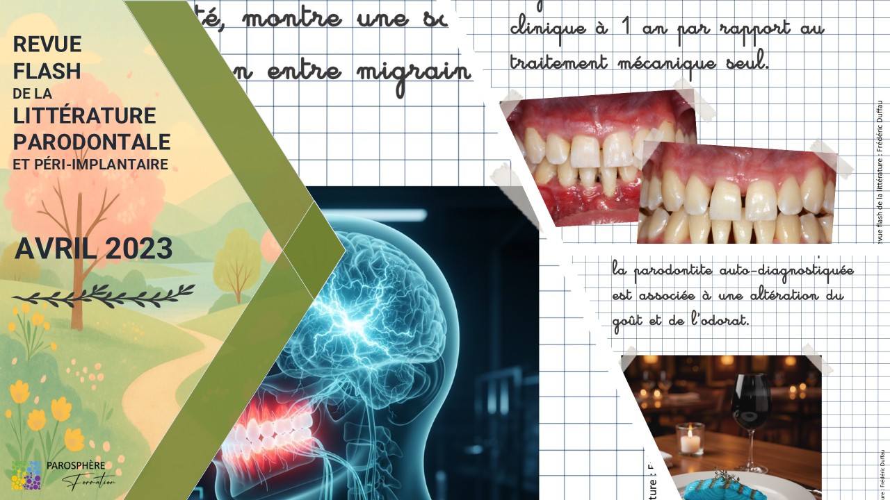Revue flash PSF | Avril 2023