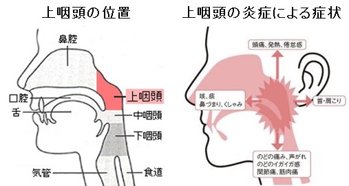 鼻うがいしてみませんか？（５）