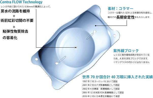 近視矯正用眼内レンズ