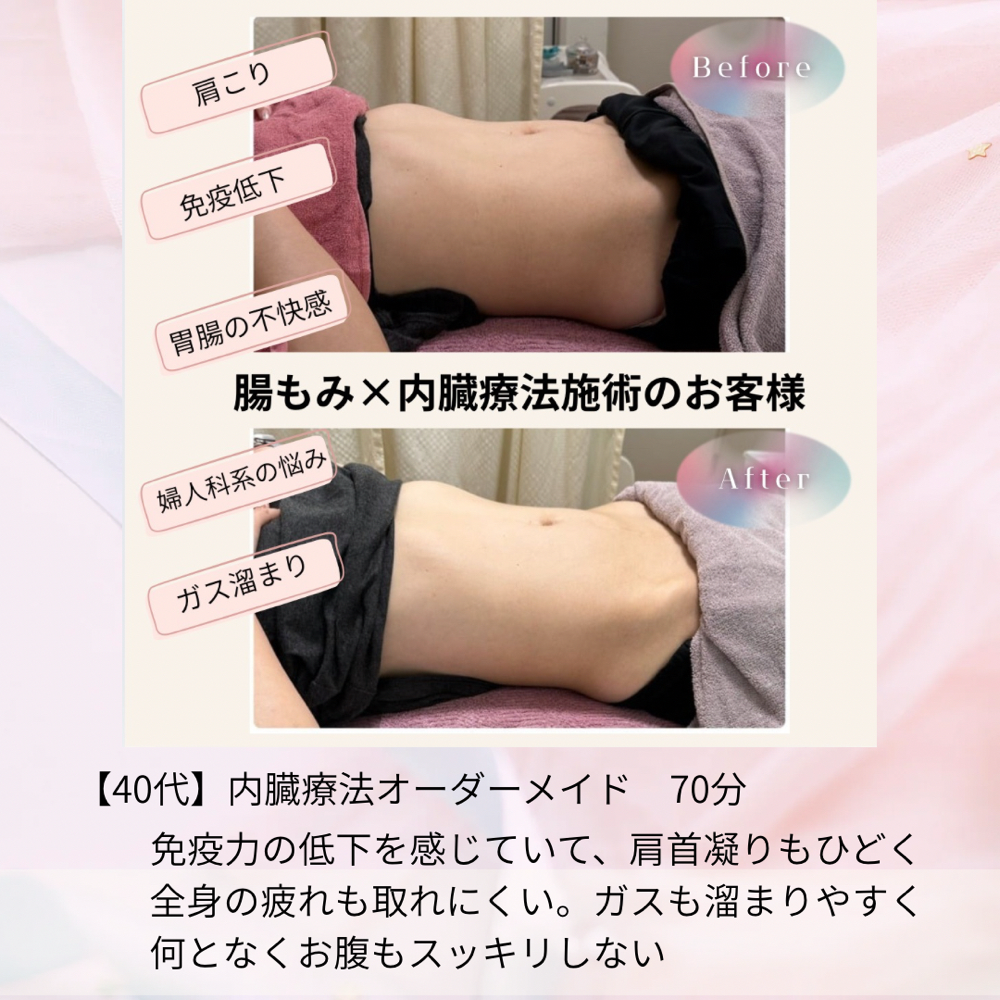 #胃腸の不調   2回施術で改善　