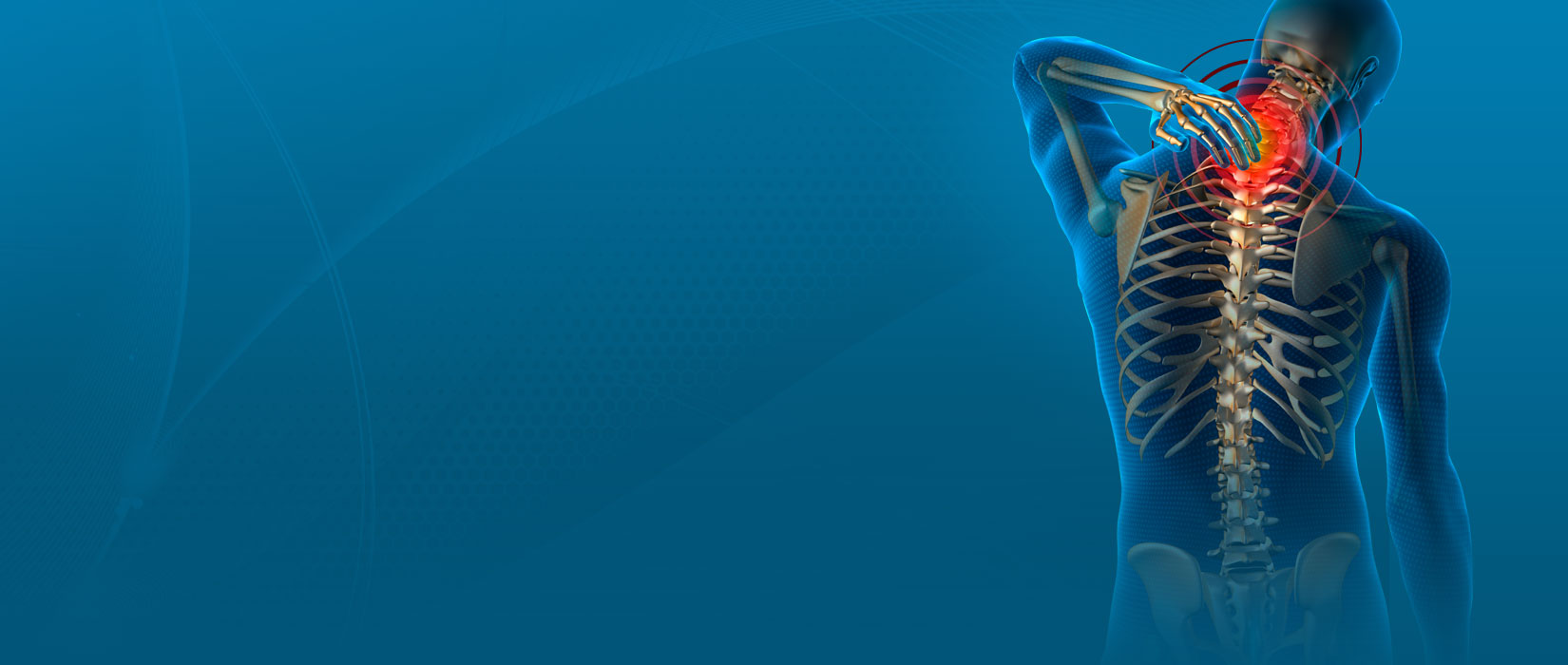 NEURALGIA INTERCOSTAL Fisioholistik