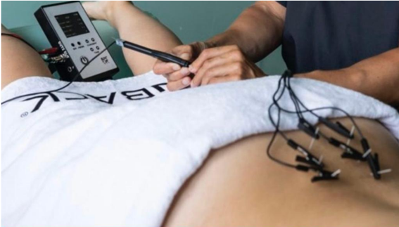 Electrólisis Percutánea Intratisular (EPI®) en el dolor agudo y crónico de espalda. Fisioterapia especializada en Palma de Mallorca