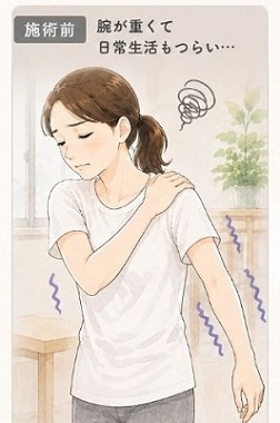 腕が重くて日常生活がつらい女性のイラスト
