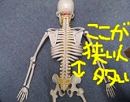 骨格模型の画像