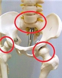 股関節と腰仙関節・仙腸関節を示した骨盤模型の画像
