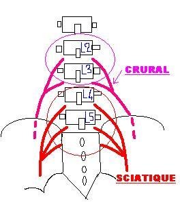 cruralgie