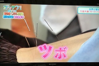 小牧 鍼灸 鍼治療 腰痛 肩こり 自律神経