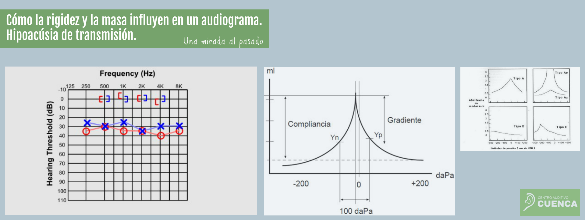 Cómo la rigidez y la masa influyen en un audiograma. Hipoacúsia de Cómo la rigidez y la masa influyen en un audiograma. Hipoacúsia de