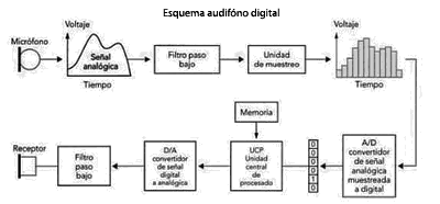 Esquema básico de un audífono digital